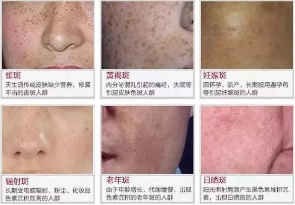 微信图片_20181126152326.jpg 微信图片_20181126152326.jpg